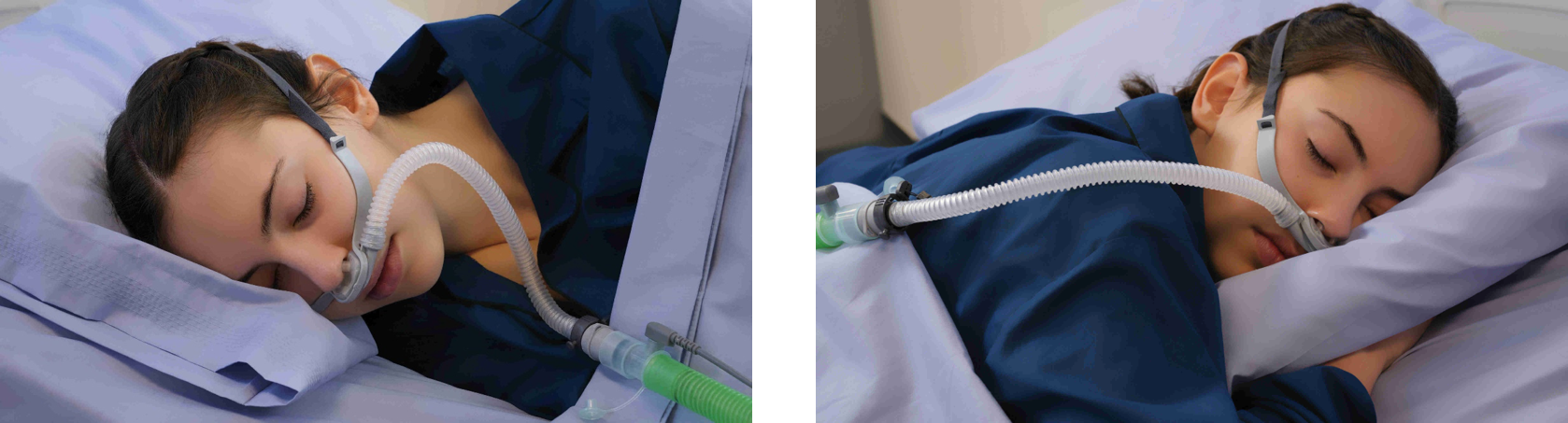 i-flo ハイフローネーザルカニューラ用 鼻カニューラ | 製品情報